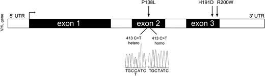 Figure 1. The schematic structure of the VHL gene. Sequencing of the second exon of the VHL gene revealed c.413C>T:P138L homozygous VHL mutation in the propositus, which was inherited from her parents, both VHLP138L heterozygous. UTR, untranslated region.