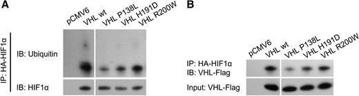 Figure 6. Immunoprecipitation assay of HIF1α ubiquitination and VHL binding. The 786-0 cells were cotransfected with plasmids expressing pVHL (pCMV6 denotes empty plasmid without VHL open reading frames) and HA-tagged HIF1α. Total protein was extracted from cells and HIF1α was precipitated with magnetic beads coupled with anti-HA antibody. pVHL binding and HIF1α ubiquitination was then tested by western blot. Samples were run on the same gel but were noncontiguous, as indicated by white spaces.