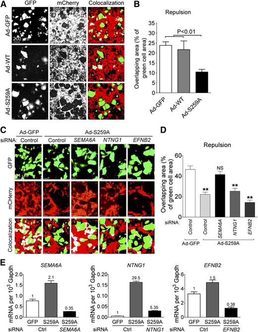 Figure 5. RAF1S259A induces SEMA6A-dependent EC repulsion. (A) Repulsion assay of HUVECs infected with ad-GFP, RAF1 WT, and S259A. Green cells are HUVECs infected with ad-GFP, RAF1 WT, and S259A and transfected with indicated small interfering RNAs (siRNAs). Red cells are HUVEC infected with mCherry lentivirus. Colocalized areas were indicated as white. (B) Quantification of repulsion assay shown in (A). Data represent mean ± SEM of 3 independent experiments. (C) Repulsion assay of HUVECs after knocking down SEMA6A, NTNG1, and EFNB2. (D) Quantification of repulsion assay shown in (C). Data represent mean ± SEM of 3 independent experiments. Knocking down efficiency is shown in (E). mRNA, messenger RNA.