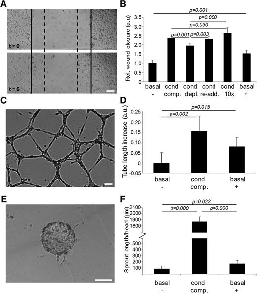 Figure 2. Endothelial exosomes stimulate migration of endothelial cells and angiogenesis. (A) Shown is an example of the cell migration assay. Borders of the scratch at t = 0 are indicated with solid lines, borders after migration at t = 6 hours with dotted lines. (B) Quantitation of HMEC cell migration assay after incubation with, respectively, (1) basal medium (basal,−); (2) conditioned medium (cond, comp.); (3) exosome-depleted conditioned medium (cond, depl.); (4) exosome-depleted conditioned medium after re-addition of exosomes (cond, re-add.); (5) reconstituted conditioned medium with 10 × concentrated exosomes (cond, 10×); and (6) purified exosomes resuspended in basal medium (basal, +). Values are normalized to condition 1 (n = 5 ± SD, ANOVA). Shown are (C) an example image of the in vitro angiogenesis assay, and (D) quantitation of mean tube lengths in the endothelial cell network formed after incubation with (1) basal medium (basal,−); (2) conditioned medium (cond, comp.); and (3) purified exosomes resuspended in basal medium (basal, +). Tubule lengths are indicated relative to condition 1 (n = 5 ± SD, ANOVA). Shown are (E) an illustrative image of a cell-seeded bead with angiogenic sprouts and (F) quantitation of average total sprout length per bead upon incubation with (1) basal medium (basal,−); (2) conditioned medium (cond, comp.); and (3) purified exosomes resuspended in basal medium (basal, +). Bars = 100 μm.