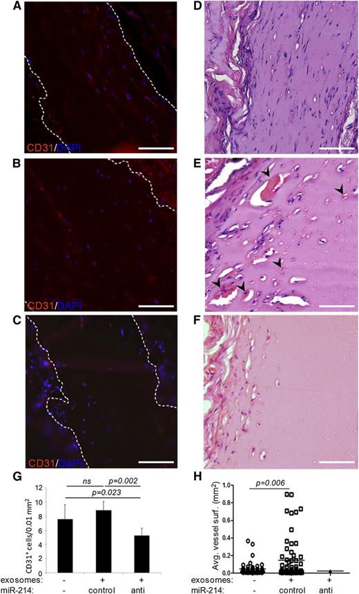 Figure 5. Functional analysis of endothelial anti–miR-214 or control miR-214 exosomes in vivo. Shown are sections of dissected Matrigel plugs that contained either no exosomes (A,D), control miR-214 exosomes (B,E), or anti–miR-214 exosomes (C,F) and had subcutaneously been grafted in mice. Sections were stained with hematoxylin and eosin (D-F) (red blood cell–containing blood vessel indicated with arrowheads), or CD31 (red) and DAPI (blue) (A-C). The graphs show (G) quantitation of murine endothelial cells that had infiltrated into the plugs and (H) blood vessel surfaces. Images were recorded at RT on an Olympus CX60 microscope using an Olympus UPlan Fl 20×/0.05 objective lens that was coupled to an Olympus DP71 camera operated using CellP software. Brightness of fluorescent images was enhanced using Adobe Photoshop software. Bars = 100 μm.