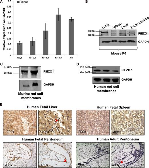 Figure 2. PIEZO1 characterization during mouse and human embryonic development. (A) PIEZO1 mRNA levels (normalized to GAPDH) in murine C57BL/6 embryos at E9.5, E10.5, E12.5, E15.5 and P0. Mean + SEM of 3 experiments. (B) Immunoblot showing expression of PIEZO1 protein expression in lung, spleen, liver, and bone marrow from P0 C57BL/6 mouse. Protein (50 μg) was loaded in each lane, with GAPDH as loading control. Representative of 2 independent fresh tissue lysate preparations. (C) Immunoblot showing PIEZO1 protein RBC membranes prepared from blood pooled from 8 adult C57BL/6 mice. Protein (50 or 100 μg) was loaded in each lane, with GAPDH as loading control. One of 3 similar experiments with independent membrane preparations. (D) Immunoblot showing PIEZO1 protein in human RBC membranes prepared from blood pooled from 3 healthy subjects for each lane. Protein (50 μg) was loaded in each lane, with GAPDH as loading control. One of 3 similar experiments with independent membrane preparations. (E) Immunohistochemical expression in human fetal (17 weeks of gestations) and adult tissues with PIEZO1 rabbit polyclonal antibody. The red arrow in the ×400 liver panel indicates a positive erythroblast. The red arrows in the fetal peritoneum panels indicate positive staining in the lymphatic vessels, while in the adult peritoneum panels indicate negative staining in the lymphatic vessels. Antigen is stained brown; nuclei are stained in purple with hematoxylin. Tissues were imaged with a Leica microscope equipped with 20× and 63× objectives. Representative of 3 independent experiments. GAPDH, glyceraldehyde-3-phosphate dehydrogenase.