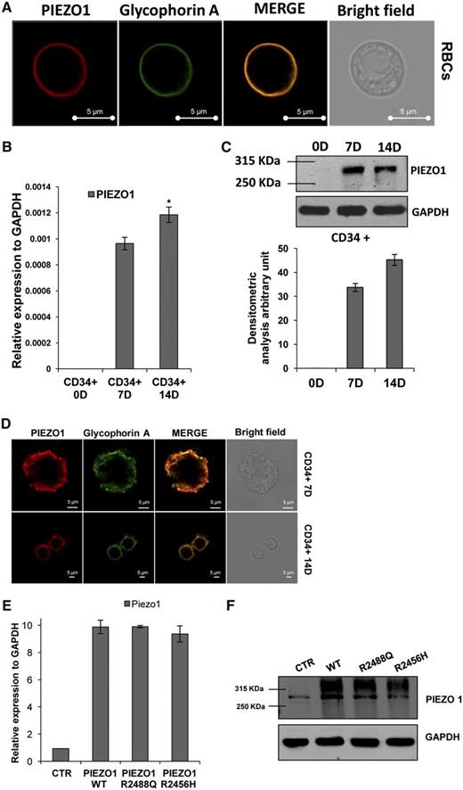 Figure 3. PIEZO1 characterization in RBCs and in CD34+ blood cells during erythroid differentiation. (A) Laser-scanning confocal immunofluorescence images of a peripheral blood smear from a control subject stained with rabbit polyclonal antibody to PIEZO1 (red) and mouse monoclonal antibody to glycophorin A (membrane marker, green), showing colocalization of the 2 signals (merge), and a bright-field image of a red cell. Cells were imaged with a Leica TCS SMD FLIM confocal microscope equipped with a 1.4 NA oil-immersion HCX PL APO CS 100× objective. Luminosity and contrast were uniformly adjusted with Axiovision software. Representative of 3 independent experiments. (B) PIEZO1 mRNA levels (normalized to GADPH) in CD34+ cells induced to erythroid differentiation by EPO at 0, 7, and 14 days by quantitative reverse transcription PCR. *P value, .003 (CD34+ 14D vs CD34+ 7D). (C) Immunoblot of PIEZO1 protein in lysate of CD34+ cells induced to erythroid differentiation at 0, 7, and 14 days (50 μg of protein; GAPDH was loading control). The graph below shows densitomteric analysis of this and similar blots. (D) Laser-scanning confocal microscopy images of CD34+ cells induced to differentiation at 7 and 14 days by EPO, showing colocalization of PIEZO1 (red) and glycophorin A (green). Cells were imaged with a Leica TCS SMD FLIM confocal microscope equipped with a 1.4 NA oil-immersion HCX PL APO CS 63× objective. Bright-field images show the morphology of CD34+ cells after 7 or 14 days of erythroid differentiation. Luminosity and contrast were adjusted using Axiovision software. (E) PIEZO1 mRNA levels (normalized to GAPDH) in HEK-293 cells transiently transfected (72 hours) with empty vector or with cDNA encoding WT PIEZO1 or PIEZO1 mutants R2488Q and R2456H. Mean + SEM of 3 experiments. (F) Immunoblot of PIEZO1 polypeptide in HEK-293 cells transiently transfected (72 hours) with empty vector or with cDNA encoding WT PIEZO1 or PIEZO1 mutants R2488Q and R2456H. GAPDH serves as loading control. One of 2 similar experiments.