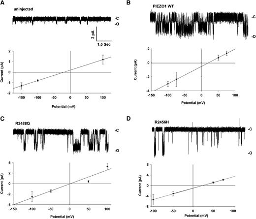 Figure 6. On-cell patch current traces of R2488Q and R2456H mutations in Xenopus oocytes. On-cell patch current traces (recorded at −applied voltage at the membrane patch (VP) = −100 mV) and current-voltage relationships from (A) uninjected oocytes and (B) oocytes previously injected with cRNA encoding WT PIEZO1, (C) PIEZO1 mutant R2488Q, and (D) PIEZO1 mutant R2456H. Single-channel slope conductances are 25 pS (wildtype), 26.5 pS (R2488Q), and 43 pS (R2456H). Supplemental Figure 3S presents a higher resolution on-cell patch trace from an oocyte expressing mutant R2456H.