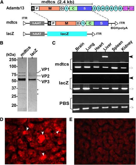 Figure 1. Construction, preparation, and expression of AAV8 vectors. (A) The schematic diagram of AAV constructs. As shown, full-length murine ADAMTS13 protein consists of a signal peptide (S), prodomain (P), a metalloprotease domain (M), a disintegrin domain (D), the first thrombospondin type 1 repeat, a Cys-rich (C), and spacer domain (S) (ie, mdtcs). More distal C-terminus of murine ADAMTS13 contains an additional 7 thrombospondin type 1 repeats (2-8) and CUB domains (for complement C1r/C1s, Uegf, Bmp1). The fragment (∼2.4 kb) encoding amino acid residues 1 to 2055 of murine ADAMTS13, a hAAT promoter, and a bovine growth hormone poly adenylation (BGH-polyA) were cloned into an AAV vector (hAAT-mdtcs). The expression cassette was flanked by 2 inverted terminal repeats (ITR). In addition, a lacZ gene and a hAAT promoter were inserted into the same vector as a control (hAAT-lacZ). (B) The purified recombinant vectors, AAV8-hAAT-mdtcs (lane 1) and AAV8-hAAT-lacZ (lane 2), revealed by Coomassie blue staining. Only 3 viral envelop proteins (VP1, VP2, and VP3) are detected in the final preparations, with the VP3 as the predominant band. Two asterisks indicate 2 minor contaminated proteins or degradation products in lane 1. (C) The amplification of murine ADAMTS13 fragment (∼0.25 kb, closed arrowheads) and β-actin (∼0.5 kb, open arrowheads) mRNA in the brain, lung, heart, liver, spleen, and kidneys in mice treated with AAV8-hAAT-mdtcs (2.6 × 1011 vg/kg) or AAV8-hAAT-lacZ or PBS, as indicated in the figure. The therapeutic transgene product was detected only in the liver of Adamts13−/− mice treated with AAV8-hAAT-mdtcs but not in the controls. (D-E) The positive (arrowheads) and negative staining with anti-murine ADAMTS13 IgG in the hepatocytes 2 weeks after intravenous administration (2.6 × 1011 vg/kg) of AAV8-hAAT-mdtcs and AAV8-hAAT-lacZ, respectively. The staining was performed on the frozen sections after being fixed with ethanol/acetic acid (9/1) for 10 minutes at −20°C. An AlexaFluor568 donkey anti-rabbit IgG (Invitrogen) was used (1:500) for detection (red).
