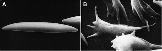 (A) Membrane deformation induced by fluid shear stress acting on normal human discoid red cells and (B) membrane deformation induced by polymerization of hemoglobin upon deoxygenation of human sickle red cells. Do these types of membrane deformation regulate PIEZO1 function?