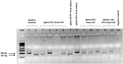 Figure 3. JAK2V617F status of LM captured or cultured ECs from spleen or splenic veins. Shown are patient number 5 (lanes 3-6), patient number 6 (lanes 7-11 and 13), and patient number 9 (lane 12). Lane 1, JAK2V617F+ control; lane 2, JAK2 wild-type positive control; and lane 14, negative control. MW indicates molecular weight. Expected sizes for amplified fragments after digestion with BsaIX are 141, 30, and 12 bp for the wild-type allele, whereas the V617F allele remains undigested (183 bp). Both the 30- and 12-bp fragments derived from digestion of the wild-type alleles ran outside the gel. Heterozygous samples show both 183-bp (mutated) and 141-bp (wild-type) fragments.
