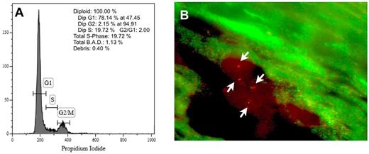 Figure 5. DNA content of cultured splenic ECs and FISH analysis of ECs in spleen sections. (A) Representative example of DNA content analysis of JAK2V617F+ ECs obtained from in vitro culture of splenic mononuclear cells of patient number 6. Cells are 100% diploid. (B) Representative microphotograph of FISH analysis of ECs in a spleen section with a dual-color anti-JAK2 probe. Two cells, each with 2 green and 2 red signals (arrows), are shown.