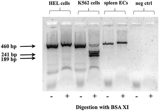 Figure 6. JAK2V617 mutation in FACS-sorted splenic ECs from patient number 6. Splenic ECs show only mutated alleles, confirming the homozygosity found in the circulating polymorphonuclear cells of this patient. The HEL cell line was used as a positive control for the JAK2V617F mutation; the K562 cell line was used as a positive control for the wild-type JAK2 gene. Amplified fragments, obtained as described in “Methods” and in Baxter et al25 are shown before (−) and after (+) digestion with BsaXI. The expected sizes for amplified fragments after digestion with BsaIX are 241, 189, and 30 bp for the wild-type allele; the V617F allele remained undigested (460 bp). The 30-bp fragment derived from the digestion of the wild-type alleles ran outside the gel.