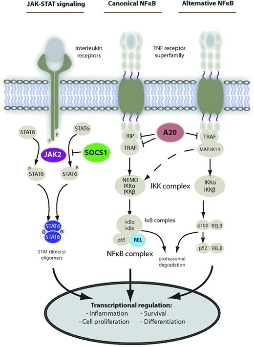 Figure 1. Main deregulated signaling pathways in PMBCL. Shown are the main activation cascades of JAK-STAT and NF-κB signaling. Alternative pathway activation exists. Known gene alterations leading to constitutive pathway activity in PMBCL are shown in color. Reprinted from Steidl and Gascoyne9 by permission of the American Society of Hematology.
