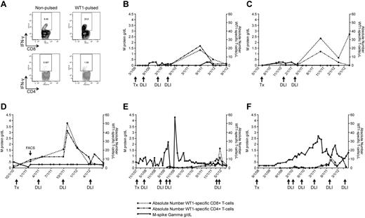 Figure 2. WT1-CTL emergence is associated with disease reduction and stabilization. WT1-CTL frequencies in the PB generally increase after DLI and fluctuate over the course of disease. WT1-CTL frequencies were quantified by intracellular IFN-γ assay in freshly isolated PBMCs. Absolute numbers of WT1-CTL were then computed and compared with the clinical marker of disease, M-spike gamma. (A) Representative FACS plots of intracellular IFN-γ production by CD8+ and CD4+ T cells against autologous nonpulsed and WT1 peptide-pulsed target PBMC (UPN1, time point indicated by “FACS” arrow in panel D). (B) UPN9; (C) UPN4; (D) UPN1; (E) UPN8; (F) UPN10.