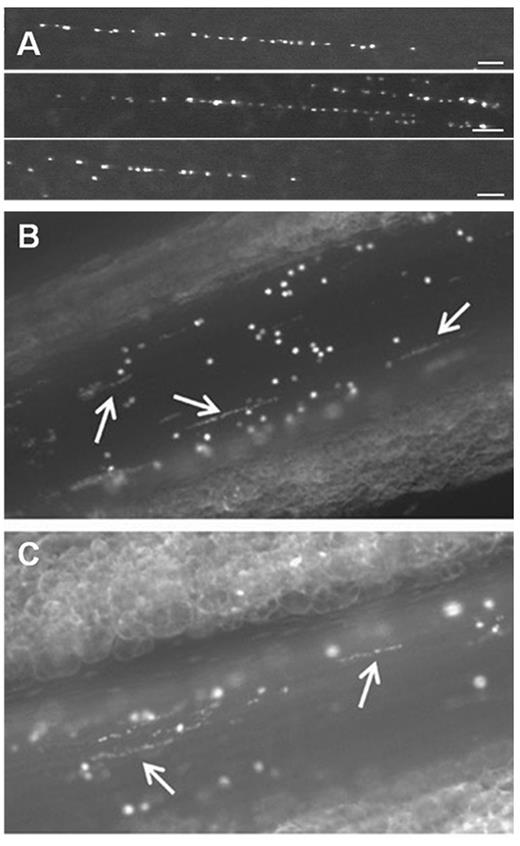 Figure 1. Platelet-decorated VWF strings rapidly appear on the surface of activated endothelial cells. (A) In vitro, platelet-decorated VWF strings are visualized by fluorescence microscopy on the surface of blood outgrowth endothelial cells perfused with washed DIOC6-labeled platelets at a shear rate of 250 seconds−1.43 Scale bar represents 50 μm. (B-C) Platelet-decorated VWF strings (white arrows) appear on the surface of mesenteric veins of Adamts13−/− mice after activation with 10% FeCl3 solution (B) or calcium ionophore A23187 (C). Endogenous platelets were labeled by intravenous administration of rhodamine 6G.42 Microscopy was performed using a Nikon Eclipse TE200 inverted fluorescence microscope equipped with a 20× PLAN objective (numeric aperture 0.4) coupled to an ORCA-R2 Hamamatsu CCD camera. Images were recorded using Hokawo software (Hamamatsu Photonics).