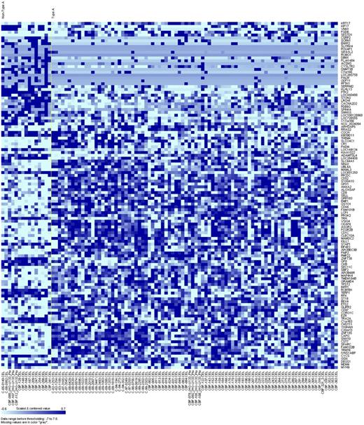 Figure 1. Heat map of the derived gene-expression signature associated with the CBFB-MYH11 fusion type (non–type A vs type A with wild-type KIT) in patients with de novo AML and inv(16)/t(16;16). Rows represent gene names and columns represent patients. Genes are ordered by hierarchical cluster analysis. Expression values of the genes are represented by color, with dark blue indicating higher expression and light blue indicating lower expression.