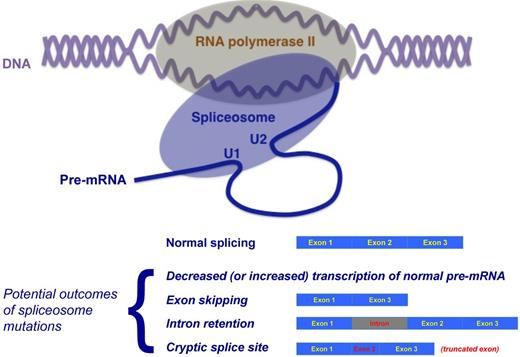 Figure 2. Schematic representation of the concept of cotranscriptional RNA splicing and potential outcomes of mutations of genes encoding proteins of the spliceosome. Top: Although transcription of nucleosome-free DNA into pre-mRNA by RNA polymerase II and pre-mRNA splicing are traditionally considered as separate and sequential processes, increasing evidence suggests that transcription and RNA processing are strictly coupled in vivo and that several splicing factors also play a role in the regulation of transcription. According to Han et al,9 cotranscriptional splicing represent a general rule with exceptions. Bottom: Potential outcomes of mutations of genes encoding proteins of the spliceosome. These outcomes include reduced (or also increased) transcription, exon skipping, intron retention, and cryptic exonic (or intronic) splice site activation with truncated (or elongated) exon. Adapted from Ebert and Bernard.4
