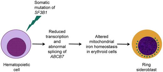 Figure 3. Schematic representation of our current understanding of the relationship between the occurrence of a somatic SF3B1 mutation and the formation of ring sideroblasts in patients with RARS. Previous studies found reduced expression of ABCB7 in CD34-positive cells and cultured erythroblasts from RARS patients,23,24 whereas a recent study has shown altered ABCB7 exon usage in primary RARS cells.36 The interconnection between DNA transcription and RNA splicing, illustrated in Figure 2, is consistent with the conclusion that a somatic SF3B1 mutation may result in reduced transcription and abnormal splicing of ABCB7.