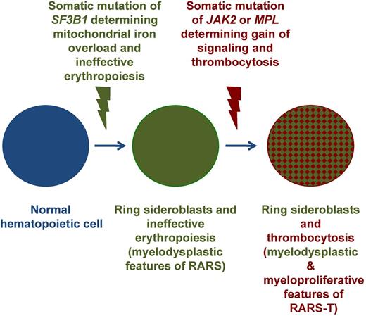 Figure 5. Schematic representation of the multistep molecular pathogenesis of RARS-T through sequential acquisition of SF3B1 and JAK2 or MPL mutations. The occurrence of a somatic mutation of SF3B1 causes mitochondrial iron overload, ineffective erythropoiesis, and anemia, typical myelodysplastic features of RARS. The subsequent occurrence of a somatic mutation of JAK2 or MPL involves the emergence of a subclone that carries 2 mutant genes (SF3B1 and JAK2 or MPL) and determines gain of thrombopoietin signaling, proliferation of large atypical megakaryocytes, and thrombocytosis, typical myeloproliferative feature of RARS-T. Adapted from Cazzola et al.44