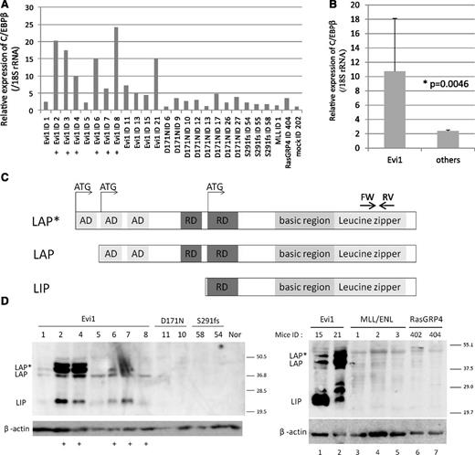 Figure 2. High expression of C/EBPβ was observed in Evi1-leukemia cells. (A) Relative expression of C/EBPβ in whole BM cells derived from Evi1-leukemia mice, AML1-related leukemia mice (D171N and S291fs), a MLL/ENL-leukemia mouse, a RasGRP4-leukemia mouse, and a mock vector control mouse. Expression levels were normalized by the expression level of 18S rRNA. The expression level of the control mouse (mock ID 202) is set to 1. Plus marks indicate retroviral integration near C/EBPβ. (B) Comparison of C/EBPβ expression level between Evi1-leukemia and other leukemia. “Others” include mice transplanted with Runx1-D171N (n = 8), S291fs (n = 3), MLL-ENL (n = 1), RasGRP4 (n = 1), or mock (n = 1) transduced BM cells. (C) Schematics of 3 isoforms of C/EBPβ. AD stands for transactivating domain, and RD indicates repression domain. The horizontal arrows point to the location of the oligonucleotide primer pairs used for RT-PCR amplification. (D) Total cell lysates of the spleen cells were immunoblotted with anti-C/EBPβ Ab (Santa Cruz, C-19) and β-actin (Cell Signaling). C/EBPβ antibody (C-19) is a polyclonal antibody raised against a peptide mapping at the C-terminus of the C/EBPβ of rat origin. The spleen cells were derived from Evi1-leukemia mice, AML1-related leukemia mice (AML1-D171N and AML1-S291fs), MLL/ENL-leukemia mice, RasGRP4-leukemia mice, and a control normal mouse. Mice ID numbers are shown at the top of panels. Plus marks indicate retroviral integration near the C/EBPβ.
