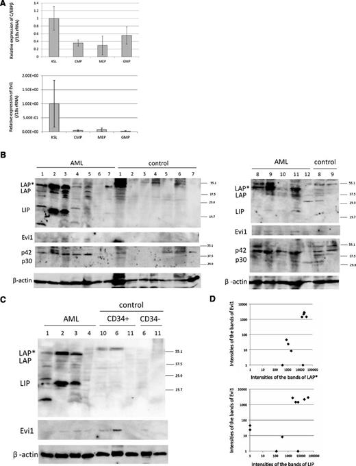 Figure 3. C/EBPβ expression in mouse HSC and human AML patients. (A) Expression of C/EBPβ and Evi1 in the BM of normal mice. The expression level of KSL is set to 1. KSL indicates c-Kit–positive, Sca1-positive and lineage-negative cells; CMP, common myeloid progenitor cells; MEP, megakaryocyte erythroid progenitor cells; and GMP, granulocyte/macrophage progenitor cells. Expression levels were normalized by the expression level of 18S rRNA. (B-C) Total cell lysates of the human whole BM cells, CD34+ cells, and CD34− cells were immunoblotted with anti-C/EBPβ Ab (top panel, Santa Cruz, C-19), anti-Evi1 Ab (second panel, Cell Signaling), anti-C/EBPα Ab (third panel, Santa Cruz, 14AA), and anti-β actin (bottom panel, Cell Signaling). CD34+/− cells of control sample ID 6 are derived from the residual PB stem cells for autologous transplantation. CD34+/− cells of control sample ID 10 and 11 are derived from BM. (D) The intensities of the bands of LAP*, LIP, Evi1, and β-actin in AML samples were quantitated by densitometry using Multi Gauge Version 3.0 software (Fujifilm). The intensities of the bands of LAP*, LIP, and Evi1 were normalized by the intensities of the bands of β-actin (n = 10). Spearman rank correlation coefficient of Evi1 and LAP* = 0.744; P = .0032. Spearman rank correlation coefficient of Evi1 and LIP = 0.679; P = .0128.