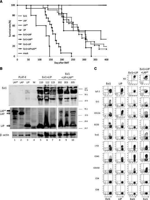 Figure 6. LIP collaborates with Evi1 to induce AML in BMT model. (A) Kaplan-Meier analysis for the mice that had received BMT. LIP synergized with Evi1 in inducing AML. Evi1 (n = 21), LIP (n = 14), LAP (n = 6), LAP* (n = 7), Evi1/LIP (n = 16), Evi1/LAP (n = 6), Evi1/LAP* (n = 6), and Evi1/LAP*/LIP (n = 5). (B) Total cell lysates of the spleen cells and PLAT-E cells transfected with pGCDNsam-LAP*, LAP, or LIP-Kusabira Orange were immunoblotted with anti-Flag Ab (top panel, SIGMA), anti-C/EBPβ Ab (middle panel, Santa Cruz, C-19), and anti-β actin (bottom panel, Cell Signaling). The spleen cells were derived from Evi1/LIP-leukemia mice and Evi1/LIP/LAP*-leukemia mice. Mice ID numbers are shown at the top of the panels. Lane numbers are shown at the bottom of the panels. Vertical lines have been inserted to indicate repositioned gel lanes. M, size markers. (C) The Evi1-leukemic cells and the Evi1/LIP-leukemic cells showed a similar surface marker profile. Flow cytometric analysis of Evi1, LIP-, Evi1/LIP-, and the Evi1/LIP/LAP*-leukemia cells. KO indicates Kusabira Orange.