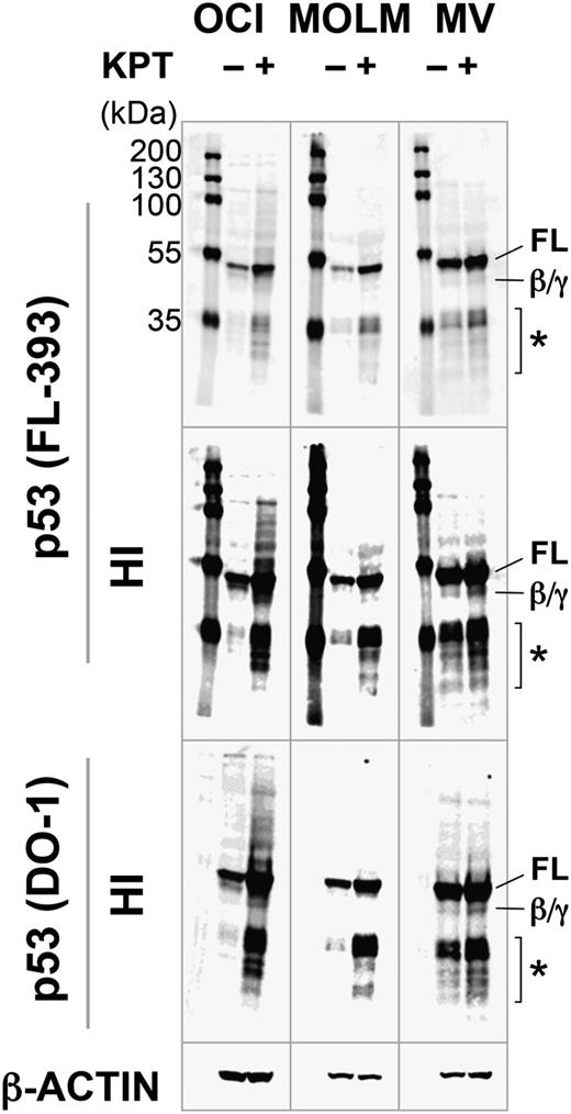 Figure 3. KPT-185 induces full-length p53. OCI-AML-3 (OCI), MOLM-13 (MOLM), and MV4;11 (MV) cells were incubated with 100 nM KPT-185 for 10 hours, and expression of p53 isoforms was determined. KPT-185 increased the levels of full-length p53 (FL) in all cell lines. p53β/γ (β/γ) was barely detected in KPT-treated OCI-AML-3 and MV4;11 cells. Asterisk (*) indicates p53 fragments from full-length p53 or p53β/γ isoforms. Results are representative of 3 independent experiments. HI, high-intensity image.