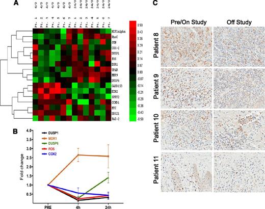 Figure 5. Examination of the MAPK pathway and Bim expression in patient samples. (A) Microarray analysis of total RNA isolated from samples of circulating tumor cells from 7 patients before romidepsin infusion (0 hours), at 4 hours after initiation of the infusion (4 hours), and 24 hours after initiation of the infusion (24 hours). An annotated list of genes that were shown to be under the control of the MAPK pathway was compiled from a series of studies and selected for analysis (supplemental Table 1). Ratios for all genes versus pretreatment values were log transformed and mean centered. An additional filter was applied to the untransformed ratios such that only genes with at least 1 ratio >2 were considered. A heatmap was then generated by using the centroid method for hierarchical clustering and Pearson correlation for the similarity metric. (B) Quantitative PCR analysis of selected MAPK-regulated genes as well as MDR-1 was performed in a subset of patients with CTCL treated with romidepsin. Genes observed to be decreased in the array in (A) were confirmed in a separate set of messenger RNA samples. (C) Bim expression as detected by immunohistochemistry in skin biopsies collected before or while on study (left column) and at disease progression (right column) from 4 patients treated with romidepsin. Magnification ×40.