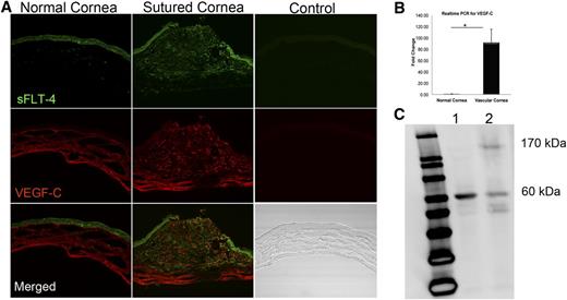 Figure 3. Corneal injury induces lymphangiogenesis, upregulation of VEGF-C, and membrane VEGFR-3 expression. (A) Immunostaining of normal and sutured cornea on day 3 reveals sVEGFR-3 and VEGF-C upregulation at the site of suture, indicating that sVEGFR-3 initially tends to capture VEGF-C and control VEGF-C surge. Negative controls are sections stained with isotype-control primary antibodies. (B) Real-time PCR of normal and sutured cornea on day 3 revealing mechanical trauma leads to instant increase in VEGF-C mRNA levels (n = 5). (C) Western blot of normal (1) and sutured cornea (2) on day 5 leads to expression of membrane VEGFR-3 (170 kDa) in sutured cornea that leads to signaling through VEGFR-3 and development of lymphatic vessels.