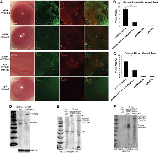 Figure 4. sVEGFR-3 knockdown leads to growth of corneal lymphatic and blood vessels and expression and phosphorylation of membrane VEGFR-3. (A) Immunofluorescent staining and confocal imaging of cornea flat mounts (n = 10 each group) injected with 2 μg pshRNA–sVEGFR-3, pshRNA-CTR, pshRNA–sVEGFR-3 + anti–VEGF-C immunoglobulin, and IgG. pshRNA–sVEGFR-3 injection leads to lymphangiogenesis in 10 days, with vessels oriented to injection site. Anti–VEGF-C antibody administration 1 day before pshRNA-sVEGFR-3 controls lymphangiogenesis. (B-C) Corneal area of blood and lymphatic vessels 10 days after pshRNA–sVEGFR-3, pshRNA-CTR, pshRNA–sVEGFR-3 + anti–VEGF-C immunoglobulin, and IgG antibody injection. Anti–VEGF-C immunoglobulin injection 1 day prior to pshRNA–sVEGFR-3 shows 75% and 56% reduction of lymphatic and blood vessels (n = 10 each group). (D) sVEGFR-3 knockdown with pshRNA–sVEGFR-3 injection into cornea is associated with expression of membrane VEGFR-3 and downregulation of sVEGFR-3 as seen in western blot with anti–N-terminal VEGFR-3 antibody. (E) sVEGFR-3 knockdown with pshRNA–sVEGFR-3 (samples harvested on day 5 after injection) is associated with phosphorylation of membrane VEGFR-3 as demonstrated via immunoprecipitation with anti–N-terminal VEGFR-3 antibody followed by western blotting with anti-phosphotyrosine antibody. (F) Stripping and reblotting the membrane with anti–N-terminal end VEGFR-3 antibody confirms that sVEGFR-3 is present after control shRNA treatment but not after pshRNA–sVEGFR-3. *P < .01 by paired Student t test. GAPDH, glyceraldehyde-3-phosphate dehydrogenase; IP, immunoprecipitation; WB, western blot.