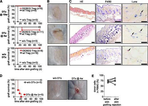 Figure 5. Upon depletion of administered Treg, host Treg are required for acceptance of skin allografts. (A-C) Sublethally irradiated WT B6 mice were grafted with DBA/2 BM under cover of 2.106 DEREG or WT Treg in vitro cultured in presence of (B6 × DBA/2)F1 antigen-presenting cells. Mice were left untreated or received diphtheria toxin (DTx) 4 or 10 weeks after reconstitution, as indicated. Skin allografts were placed 6 weeks after BM grafting. Control mice were not injected with Treg at the time of BM transplantation. (A) Skin allograft survival was monitored daily by assessment of macroscopic signs of rejection. Graft-survival curves for indicated conditions (4 independent experiments). Representative macroscopic (B) and histologic (C) features of skins 100 days after transplantation. (HE, hematoxylin and eosin; F4/80, immunohistocheministry with antibody to the macrophage marker F4/80; Luna, Luna’s eosinophil stain) Scales represent 200 µm for HE and F4/80 staining and 20 µm for Luna staining. (D-E) Sublethally irradiated DEREG mice were grafted with DBA/2 BM under cover of DEREG Treg in vitro cultured in presence of (B6 × DBA/2)F1 stimulator cells. Injected Treg were depleted or not by diphtheria toxin (DTx) injection 4 weeks after BM grafting. DBA/2 Skin transplantation was performed 2 weeks later. Skin allograft survival was monitored daily. (D, left panel) Skin allograft survival during the 100-day observation period. (D, right panels) In toxin-treated mice, rejection was macroscopically clearly visible (2 independent experiments). (E) Chimerism was analyzed in PBMC 2 days before skin transplantation and immediately after rejection in toxin-treated mice.