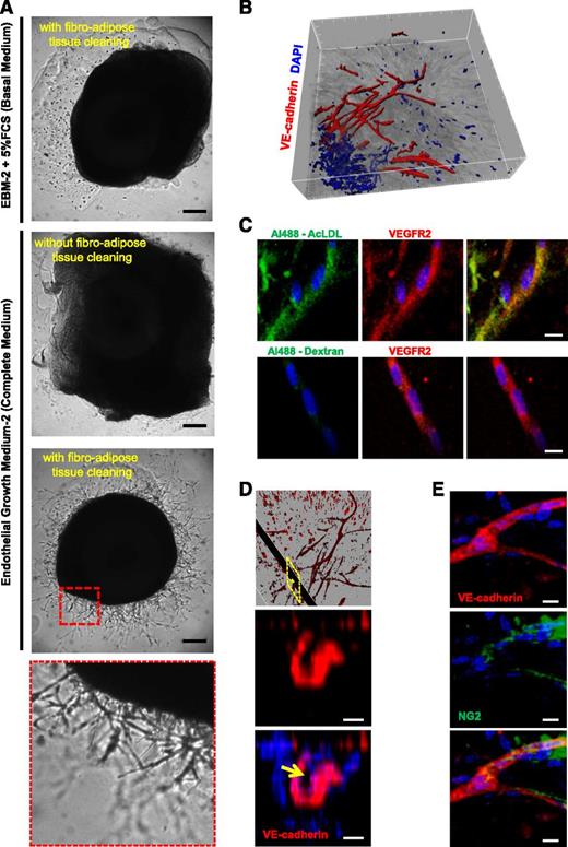Figure 1. Characterization of 3D hAR cultures. (A) hARs sprout in the presence of EGM-2 but only after fibroadipose tissue cleaning. Representative micrographs of hARs with or without fibroadipose tissue cleaning, cultured with 5% FCS EBM-2 (Basal medium) or with EGM-2 (complete medium). The bottom micrograph is a magnification of the red dotted line square. Scale bar represents 200 μm. (B) 3D isosurface rendering of hAR sprouting of whole-mount immunofluorescence staining for VE-cadherin (red) and nuclei (blue) acquired through confocal microscopy. Tickmarks on axis represent 50 μm. (C) Confocal images of hAR sprouts treated with Ac-LDL or Dextran in green and stained with anti-VEGFR2 Ab in red and with DAPI in blue. Scale bar represents 10 μm. (D) Sprout lumen is shown by 3D rendering of magnification of (B) and z-stack section of yellow dotted line rectangle of hAR sprouting outgrowth stained for VE-cadherin (red) and nuclei (blue). The yellow arrow indicates the capillary lumen. Scale bar represents 5 μm. (E) Pericytes coverage. Immunostaining of whole-mount hARs with anti-VEcadherin (red), NG-2 (green), and nuclear staining with DAPI (blue). Scale bar represents 10 μm.