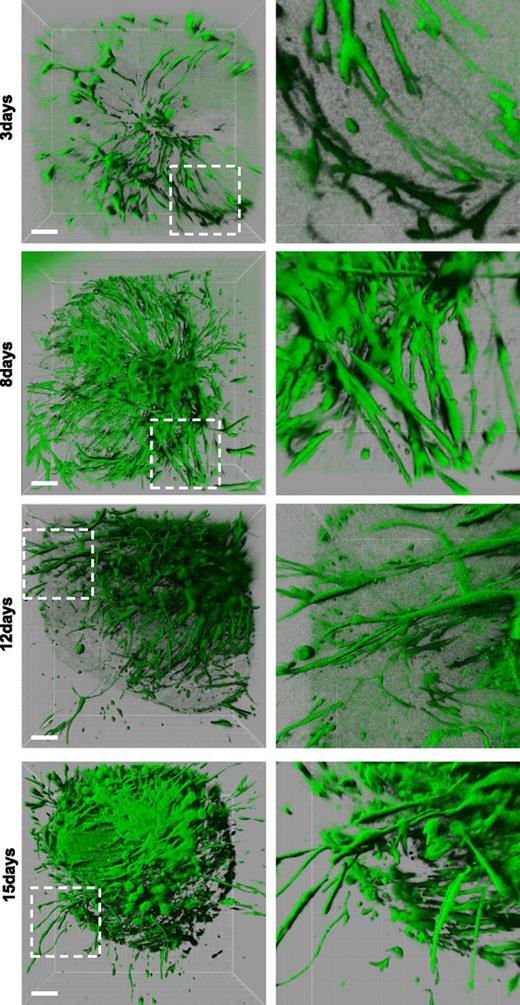 Figure 4. Morphogenesis of GFP lentiviral-transduced hARs. hARs stably transduced with lentiviruses carrying pLKO.1-GFP before gel embedding. Three-dimensional rendering reconstruction of high-resolution confocal stacks of representative hARs at indicated days of culture. Magnification is shown in the right column. Scale bar represents 200 µm.