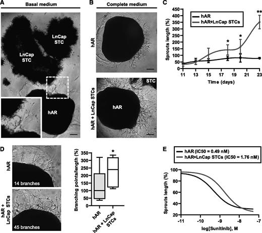 Figure 6. Use of the hAR model to test the angiogenic potential of tumor cells. (A) Representative photograph of hARs cocultured with LNCaP STC for 30 days in basal medium (EBM-2 plus 10% FCS). The inset shows higher magnification of the same photograph. Scale bar represents 400 µm. (B) Representative micrographs of angiogenic outgrowth of hARs with or without LNCaP STCs for 25 days. Scale bar represents 400 µm. (C) Time course of angiogenic outgrowth length (normalized to day 25 of hARs alone) of hARs cultured with complete medium (EGM-2) with or without LNCaP STCs (shown in B). Values shown are mean ± SD of 3 independent experiments, each from 6 different umbilical cords (*P < .05 vs hARs alone; **P < .01; ***P < .001). (D) Branching density analysis in tumor hARs. Representative micrographs and quantifications of angiogenic outgrowth of hARs with or without LNCaP STCs for 25 days. Values shown are box-and-whisker plots of branching points number divided by sprout lengths and normalized to the median of hARs alone (*P < .05 vs hARs alone). (E) Dose-response normalized inhibitor curve fittings for evaluation of IC50 of Sunitinib treatment on hARs alone or with LNCaP STCs. Equation “log(inhibitor) vs normalized response” Y = 100/(1+10^((X-LogIC50))). Nonlinear regression R2 > 0.7.
