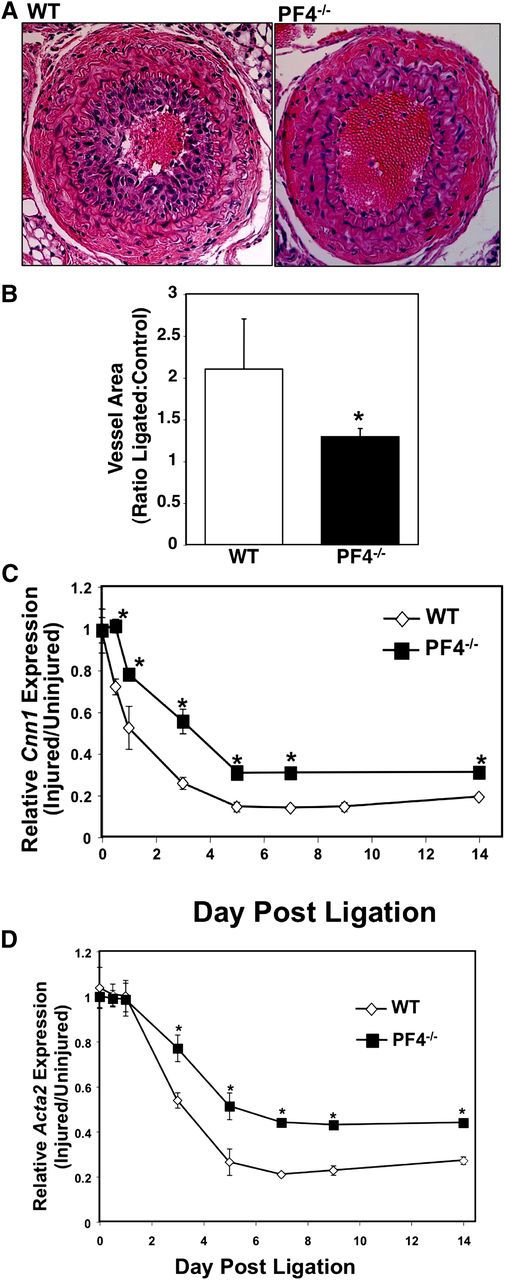 Figure 3. Mice lacking PF4 have an attenuated VSMC inflammatory phenotype switch. (A) Representative image and (B) quantification of vessel wall area. Ligated carotid arteries were isolated 21 days after ligation, and the vessel wall area was measured at multiple levels of 200 µm apart and expressed as a ratio compared with internal control nonligated right carotid (n = 5 ± SD; *P < .01 vs WT). (C-D) PF4−/− mice have less of a decline in VSMC differentiation markers in vivo. Carotids were isolated multiple days after ligation, and mRNA expression was quantified by qRT-PCR. (C) Cnn1 expression and (D) acta2 (n = 5 ± SD; *P < .01 vs WT).