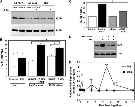 Figure 7. PF4 drives VSMC proinflammatory response in a KLF4-dependent manner. (A) KLF4 overexpression. HCASMCs were infected with a KLF4-expressing adenovirus (5 and 10 MOI), a control LacZ adenovirus (10 MOI), or were null infected. Controls were also treated with buffer or PF4 (1 µg/mL). Representative KLF4 expression western blot. (B) Overexpression of KLF4 increases IL-6 production (n = 3 ± SD; *P < .01). (C) Inhibition of KLF4 expression decreases IL-6. HCASMCs were treated with scramble control siRNA or KLF4-specific siRNA before PF4. IL-6 was measured by ELISA (n = 3 ± SD; *P < .01). (D) Western blot confirmation of KLF4 knockdown by siRNA. (E) PF4 increases Klf4 expression in vivo. Ligated left carotid Klf4 expression relative to internal control nonligated right carotid was determined by qRT-PCR in WT and PF4−/− mice (n = 5 ± SD; *P < .05, **P < .01 vs PF4−/−).
