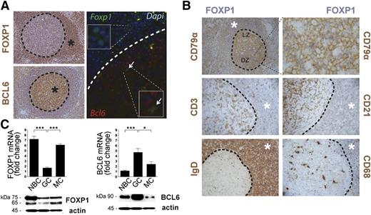 Figure 1. Inverse correlation of FOXP1 and BCL6 expression in GC. (A) Representative images of human tonsil reactive sections examined by IHC (left panels) using anti-FOXP1 and anti-BCL6 antibodies (brown). Also, FOXP1 (green) and BCL6 (red) expression were examined by immunofluorescence (right panels) in human tonsils. * denotes areas of positive signal. Arrows indicate cells that coexpress FOXP1 and BCL6 at the onset of the GC. (B) Double IHC in human tonsil sections for FOXP1 (blue) and other surface markers, including CD79α+ or IgD+ B cells, CD3+ T cells, CD21+ follicular dendritic cells, and CD68+ macrophages (brown). * denotes areas of positive FOXP1 signal (blue). (C) qRT-PCR (top) and immunoblot (bottom) analysis of FOXP1 and BCL6 expression from naïve (NBC), GC, and memory (MC) B cells isolated from human tonsils. qRT-PCR gene expression is shown relative to GAPDH. Bars show mean ± standard error of the mean (SEM) from at least 6 human tonsils. Significance was determined by 2-tailed unpaired Student t tests. Representative western blots from 2 independent experiments are shown. NBC, naïve B cells; MC, memory B cells; mRNA, messenger RNA.