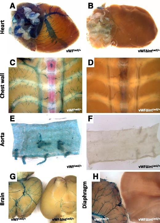 Figure 4. LacZ staining of whole-mount organs from vWFLacZ/+ and vWFΔIntLacZ/+ mice. Hearts, chest walls, en face aortae, brains, and diaphragms were harvested from 6- to 8-week-old male (A,C,E,G,H) vWFLacZ/+ mice and (B,D,F,G,H) vWFΔIntLacZ/+ mice and processed in parallel for whole-mount staining with X-Gal. (G) Brain from the vWFLacZ/+ mouse is on the left, and the brain from the vWFΔIntLacZ/+ mouse is on the right. (H) Diaphragm from the vWFLacZ/+ mouse is on the left, and the diaphragm from the vWFΔIntLacZ/+ mouse is on the right. Whole-mount tissues were analyzed under a Nikon SMZ-U dissecting microscope, and microphotographs were collected using a Nikon Coolpix 8400 camera.