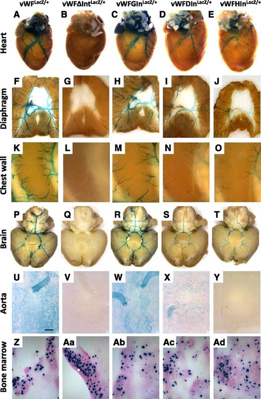 Figure 6. LacZ staining of whole-mount organs and bone marrow from vWF-LacZ knockin mice with or without native or heterologous intron. (A-E) Hearts, (F-J) diaphragms, (K-O) chest walls, (P-T) brains, and (U-Y) en face aortae were harvested from 6- to 8-week-old male vWFLacZ/+, vWFΔIntLacZ/+, vWFGInLacZ/+, vWFDInLacZ/+, and vWFHInLacZ/+ mice and processed in parallel for whole-mount staining with X-Gal. The chest wall shows the intercostal space between two ribs (a superior rib on the left and an inferior rib on the right). (Z,Aa-Ad) Bone marrow aspirates were stained for LacZ. Whole-mount tissues were analyzed under a Nikon SMZ-U dissecting microscope, and microphotographs were collected using a Nikon Coolpix 8400 camera. Scale bar, 200 μM.