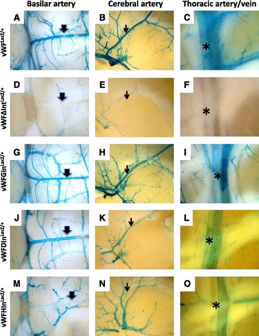 Figure 7. Comparison of LacZ staining in arteries from vWF-LacZ knockin mice with or without native or heterologous intron. Organs were harvested from 6- to 8-week-old male mice and processed in parallel for whole-mount staining with X-Gal. Shown are the basilar artery (thick arrow), middle cerebral artery (thin arrow), and internal thoracic artery (asterisk) from vWFLacZ/+ mice (A, B, and C, respectively), vWFΔIntLacZ/+ mice (D, E, and F, respectively), vWFGInLacZ/+mice (G, H, and I, respectively), vWFDInLacZ/+ mice (J, K, and L, respectively) and vWFHInLacZ/+ mice (M, N, and O, respectively). Note the reduced LacZ staining in basilar artery, middle cerebral artery, and internal thoracic artery from vWFHInLacZ/+ mice. Whole-mount tissues were analyzed under a Nikon SMZ-U dissecting microscope, and microphotographs were collected using a Nikon Coolpix 8400 camera.