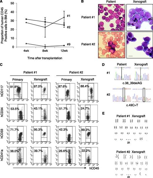 Figure 1. TAM cells engrafted in NOG mice. (A) Proportion of human CD45+ cells in the BM of NOG mice at 4, 8, and 12 weeks after transplantation (n = 3–5 per group). (B) May-Giemsa staining of the BM smear of patients and cytospin preparation of human CD45+ cells in the recipient NOG mice. Blast cells with cytoplasmic blebbing consistent with megakaryocytic differentiation were present in the BM of recipient mice. (C) Surface marker analysis of engrafted TAM cells. Human CD45+ TAM-derived cells expressing hCD117, hCD34, hCD33, and hCD41a are detected in the recipient’s BM. Blast cells were identified by CD45/SSC gating, and debris (low forward scatter) and dead cells (4′,6-diamidino-2-phenylindole positive) were excluded from the analysis. A representative result of >3 experiments is shown. (D) Genomic direct sequencing shows the presence of concordant GATA1 mutation in xenograft and original patients (1 and 2). (E) G-band karyotyping of TAM-derived cells in recipient murine BM shows no additional chromosome abnormality apart from constitutional trisomy 21, consistent with the findings in the original patients. The GATA1 mutation and the karyotype of engrafted cells from patient 9 were not assessed because of a low cell number.
