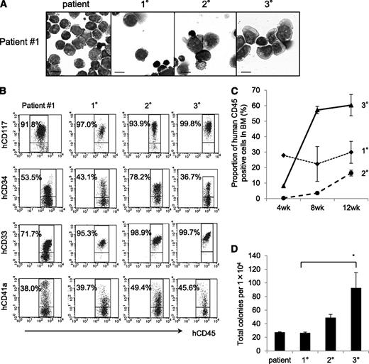 Figure 2. The NOG mouse model can support self-renewal of TAM-derived cells. (A) May-Giemsa staining of TAM-derived cells in recipients of patient 1. (B) Surface marker analysis of TAM-derived cells in recipients by flow cytometry. Viable cells were gated according to their forward scatter (FSC) and 4′,6-diamidino-2-phenylindole staining, blast cells were identified by CD45/SSC gating, and hCD45+-gated cells were tested for the expression of hCD117, hCD34, hCD33, and hCD41a. (C) Proportion of hCD45+ cells in BM of 1°, 2°, and 3° recipient mice at 4, 8, and 12 weeks after transplantation. (D) Colony assay of hCD45+ cells in BM of 1°, 2°, and 3° recipient mice. hCD45+ cells were seeded at 1.0 × 104 cells per 35-mm dish in triplicate, and the number of colonies in each dish was counted. Bars represent the standard deviation of the mean of 3 independent experiments. *Significant difference (P < .05).