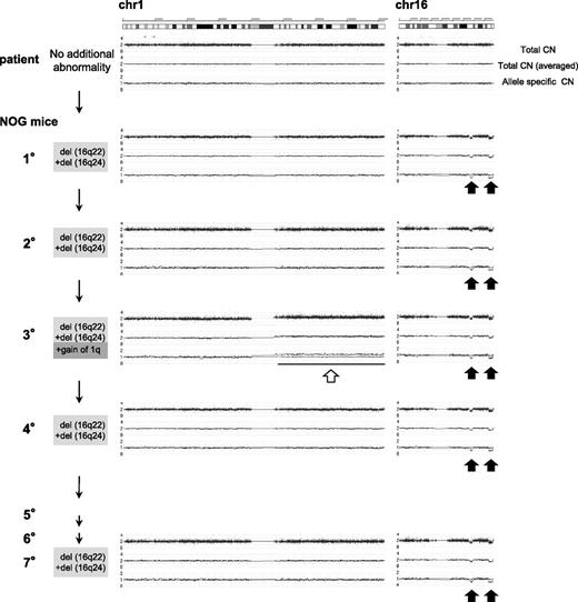 Figure 3. Sequential CNA analysis of TAM-derived cells in the recipients of patient 1. DNA obtained from the original patient sample and sorted hCD45+ recipient BM cells were analyzed by Affymetrix GeneChip Mapping 250K arrays and compared with the PB sample of the original patient in complete remission phase. The primary sample of the patient in TAM phase (blast 92%) had no CNA. hCD45+ BM cells of 1° to 7° recipients had a hemi-allelic deletion in regions 16q22 and 16q24 (black arrows). The 3° recipient had a gain of the entire arm of chromosome 1q (white arrow) in addition to deletion of 16q22 and 16q24. Arrowhead indicates abnormal CNA.