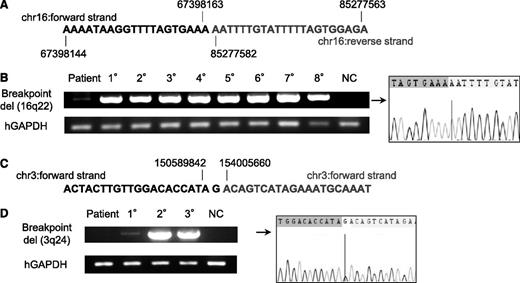 Figure 5. A minor subclone with additional CNAs was present in the primary TAM patient sample, whereas a new clone emerged in a 1° recipient. (A) Contig of del(16q22) breakpoint deduced by whole genome sequencing of the clone containing del(16q22) and del(16q24) in patient 1. Details are shown in supplemental Figure 6. (B) Breakpoint-specific PCR for the del(16q22) clone using genomic DNA from the original patient sample (1; PB in TAM phase), 1° to 8° xenografts (hCD45+ BM cells; Figure 3), and NC (negative control; PBMCs from a healthy adult). Cells from 1° to 8° recipients showed a bright band. The original patient sample showed a faint band, and direct sequencing revealed the presence of the deduced breakpoint for del(16q22). Human glyceraldehyde-3-phosphate dehydrogenase (hGAPDH) was used as an internal control. (C) Contig of del(3q24) breakpoint deduced by whole-genome sequencing. Details are shown in supplemental Figure 9. (D) Breakpoint-specific PCR for the del(3q24) clone using genomic DNA from the original patient sample (1; PB in TAM phase), 1° to 3° xenografts (hCD45+ BM cells, m2–5; Figure 4A), and NC. Cells from 2° and 3° recipients showed a bright band. No band was detected in the original patient sample, but a faint band was detected in the 1° recipient sample. hGAPDH was used as an internal control. Direct sequencing confirmed the presence of cells with the deduced breakpoint for del(3q24) in the 1° recipient.