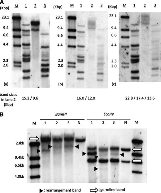 Figure 1. Clonality analysis of expanded lymphocytes. (A) SBA of HTLV-1. (a) PB of pretransplantation, (b) day 18 of transplantation, and (c) day 71 of transplantation. Band sizes in lane 2 in each panel are shown at the bottom. M, size marker (λDNA/HindIII); lane 1, positive control; lane 2, DNA digested with Eco R1; lane 3, DNA digested with Pst1. (B) SBA of T-cell receptor Cβ1 genes. Lane 1, PB of pretransplantation; lane 2, day 18 of transplantation; lane 3, day 71. Arrows indicate germ-line bands; arrowheads indicate rearranged bands. M, molecular weight marker II; N, negative control (placenta DNA).