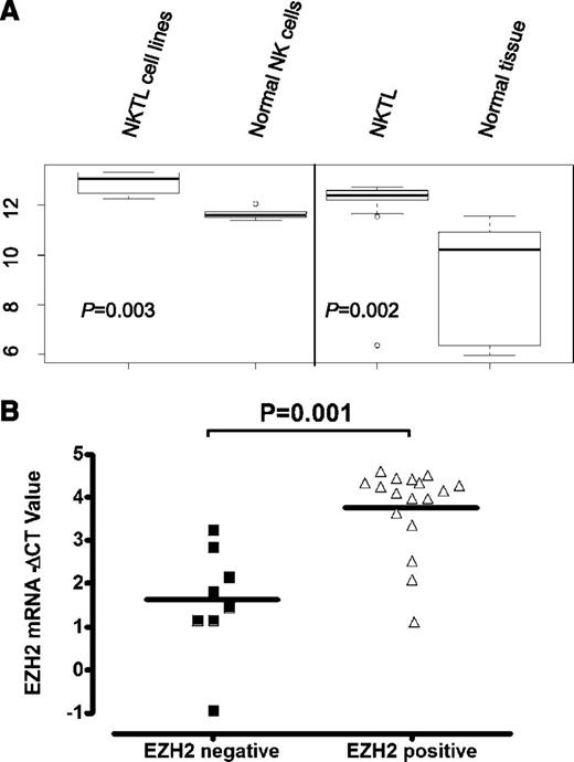 Figure 1. EZH2 mRNA levels are elevated in NKTL and cell lines. (A) Expression score for EZH2 mRNAs in NKTL GEP dataset. EZH2 gene expressions in NKTL FFPE samples were compared with that in respective normal FFPE tissue controls, as well as the NK cell lines and normal NK cells using significance analysis of microarray. (B) Correlation between EZH2 transcript levels determined by qRT-PCR and EZH2 protein levels measured by IHC for NKTL samples.