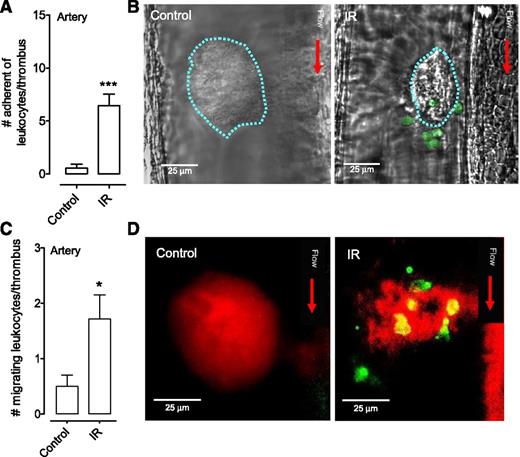 Figure 3. Leukocyte recruitment by platelet thrombi in injured arteries. (A-D) C57Bl/6 mice were administered an anti–Gr-1 Ab and DiOC6 prior to needle injury of arteries. Subsequent leukocyte thrombus interactions were monitored by DIC and fluorescence microscopy. The number of (A) stably adherent leukocytes and (C) migrating leukocytes to the site of vascular needle injury were quantified in sham-operated C57Bl/6 mice (Control), and mice subjected to IR injury (IR) (mean ± SEM; Control group: n = 7 mice with 13 injuries; IR group: n = 8 mice with 14 injuries). (B) Representative DIC images of thrombi induced by needle injury in sham-operated mice (Control) or mice after IR injury (IR). Note the (B) significant leukocyte recruitment (pseudo-colored green) and (D) migration (Gr-1 Ab, green) to thrombi after IR injury. *P < .05; ***P < .001.