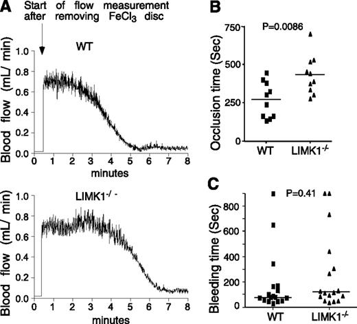 Figure 1. The effects of LIMK1 knockout on in vivo thrombosis and hemostasis. (A-B) FeCl3-induced occlusive thrombosis in carotid arteries of LIMK1−/− and wild-type (WT) mice. (A) Typical charts of FeCl3-induced occlusive thrombosis in WT and LIMK1−/− mice as indicated by carotid artery blood flow. (B) The occlusion times for each mouse are shown as squares (WT, n = 10) or triangles (LIMK1−/−, n = 10). The horizontal bars represent the mean occlusion time (P = .0086, Student t test). (C) Tail bleeding times of each mouse are shown as squares (WT, n = 17) or triangles (LIMK1−/−, n = 17). The horizontal bars represent the median bleeding time (P = .41, Mann-Whitney U test).