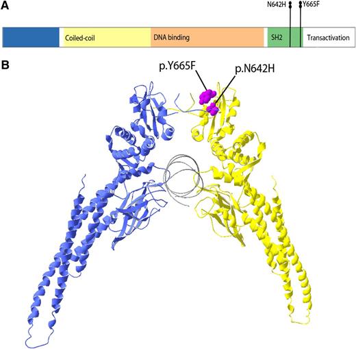 Figure 2. Linear representation of STAT5b mutation locations and structure model of STAT5b homodimer. (A) The STAT5b protein domains and localizations of the mutations. Both STAT5b mutations Y665F and N642H are located in the SH2 domain of STAT5b protein. (B) A 3-dimensional model of STAT5b protein structure. The mutations Y665F and N642H are located on the surface of SH2 domain and are colored in purple. F, phenylalanine; H, histidine; N, aspartic acid; and Y, tyrosine.