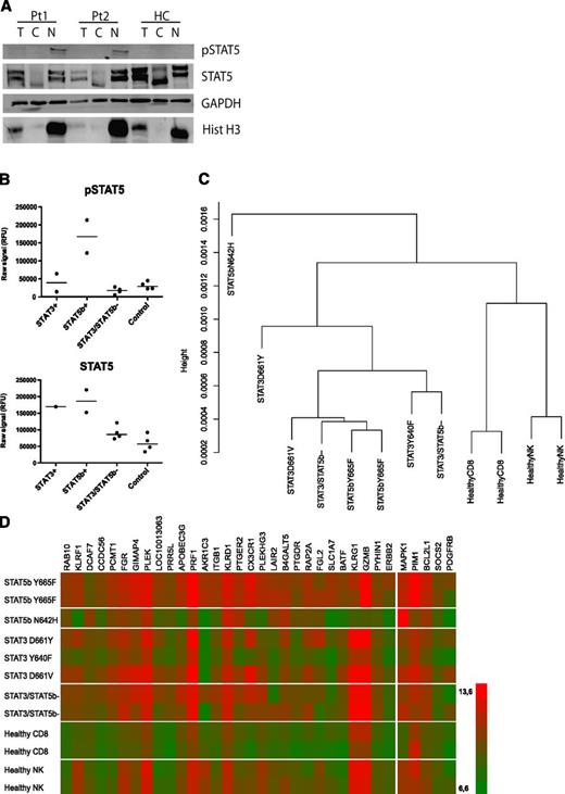 Figure 4. STAT5b is phosphorylated and localized in the nucleus leading to increased expression of STAT5 target genes in patients with Y665F mutation. (A) MNC samples from LGL patients 1 and 2 (Table 1) carrying the Y665F STAT5b mutation, and a healthy donor were fractionated. Normalized aliquots of total cell (T), cytosolic (C), and nuclear (N) fractions were separated on an SDS-PAGE gel, transferred to PVDF membrane, and western blot analysis was performed using anti-pSTAT5, anti-STAT5 anti-GAPDH (protein loading control), and anti-Histone H3 antibodies (nuclear localization control). (B) Phospho-STAT5 and STAT5 expression were analyzed by ELISA using PB MNC samples from 2 LGL leukemia patients with STAT3 mutation (Y640F and D661V), 2 patients with STAT5b Y665F mutation, 4 patients without STAT3/STAT5b mutation, and 4 healthy controls. (C) A dendrogram showing the clustering analysis of LGL leukemia patients and healthy controls based on the gene expression profile. (D) A heatmap reflecting gene expression profile of 2 LGL leukemia patients with STAT5b mutation Y665F, 1 patient with STAT5b mutation N642H, 3 patients with STAT3 mutation, 2 patients with STAT3/STAT5b WT, and 4 healthy controls. Shown are 29 upregulated genes (log2 scale) based on the comparison between STAT5b Y665F mutated patients and healthy controls (CD8+ cells). On the right, data from 5 known STAT5b target genes are displayed.