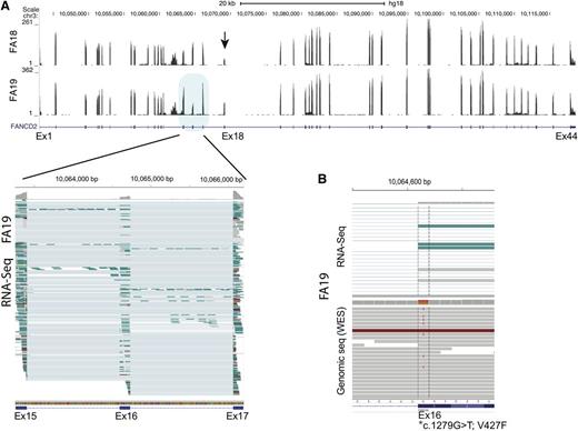 Figure 3. FANCD2 expression analysis from RNA-seq data for FA18 and FA19 LCL cell lines. (A) Wiggle plot displaying RNA-seq read coverage along with the UCSC FANCD2 gene track (shown below). Data from FA18 and FA19 are shown on top and bottom, respectively. The number of sequence reads (range) is indicated on the y-axis and is reflected by the height of the peak for each exon. The decreased number of sequence reads for exon18 (arrow) is apparent for FA18. This reflects the 4.7-kb genomic deletion that removes this exon. Multiple individual RNA sequence reads from FA19 spanning exons 15 to 17 (blue shade) are displayed in the lower panel (generated using the IGV program). Each horizontal line is an independent sequence. The thicker rectangle at each exon shows the mapped RNA sequences, while the thin line connects the gaps (introns) and connects the sequences from a single read. It is apparent that several sequence reads that include both exon 15 and 17 do not include the sequence for exon 16 (thin line), which is evidence of exon skipping. At the top of each exon, the gray color reflects the number of sequences at single-base resolution. Reduction in the reads for exon 16 compared with the 2 flanking exons is readily apparent. (B) Display of a cross section of RNA-seq (top) and genomic (bottom) sequence read alignments for FA19 in the region spanning the first nucleotide of exon 16 (*) that carries a missense mutation (c.1279G>T; p.V427F). Some of the genomic sequence reads show the heterozygous mutant T allele while RNA-Seq shows no reads with the mutant allele, indicating that the allele carrying the exon 16 mutation is skipped during messenger RNA splicing.