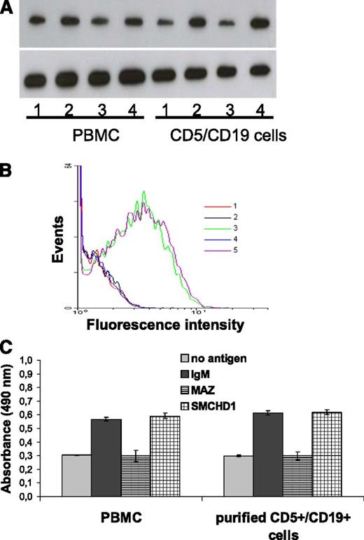 Figure 6. Induction of MYC and Ki67 protein expression as well as proliferation of leukemic CLL cells by binding of their autoantigenic BCR target. Shown is the analysis of PBMC from CLL patients (containing 82% CD5+/CD19+ cells) and purified (>95%) CD5+/CD19+ CLL cells derived from patient 45 after binding of the autoantigenic CLL-BCR target SMCHD1, the irrelevant CLL-BCR target MAZ, and αIgM. (A) Induction of MYC protein expression. 1, without antigen; 2, cells + αIgM; 3, cells + irrelevant antigen MAZ; 4, cells + specific antigen SMCHD1. (B) Flow cytometric analysis: Ki67 staining of purified CD5+/CD19+ cells. 1, unstained cells; 2: cells without antigen; 3, cells + αIgM; 4, cells with irrelevant antigen MAZ; 5, cells with specific antigen SMCHD1. (C) Proliferation of CLL cells as measured by EZ4U assay. PBMCs from CLL patient (left); purified CD5+/CD19+ CLL cells (right). The 4 columns represent, from left to right, no antigen, αIgM, unspecific antigen MAZ, and specific antigen SMCHD1.