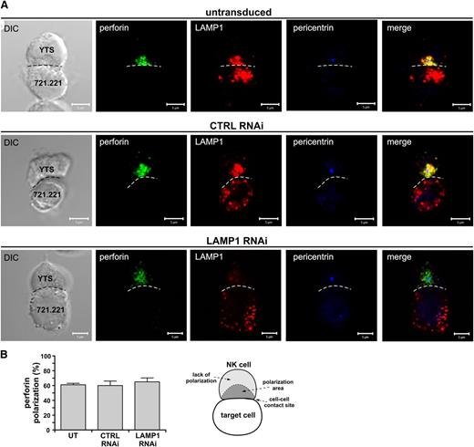 Figure 3. Effects of LAMP1 silencing on recruitment of perforin to the immunologic synapse. (A) YTS cells, untransduced or transduced with control (CTRL) or LAMP1 RNAi, were activated by mixing with 721.221 target cells for 30 minutes at 37°C. The cells were next fixed and stained with Ab’s against LAMP1 (red), pericentrin (MTOC marker; blue), and perforin (green). The dashed line indicates the position of the immunologic synapse. Scale bars represent 5 μm. (B) The percentages of perforin polarization to the immunologic synapse in YTS cells conjugated with 721.221 target cells, as in (A). Error bars represent SD. The values were determined by evaluation of 150 conjugates for each indicated YTS cell group in 3 experiments. The diagram (right) illustrates the scoring model. Perforin was regarded as polarized if it localized to a conical area (dark gray region in the diagram labeled as polarization area), limited by the center of the cell and the edge points of the cell-cell interface (shown as the dashed line in the illustration), and the MTOC (as determined by pericentrin staining) was adjacent to the cell-cell contact site.